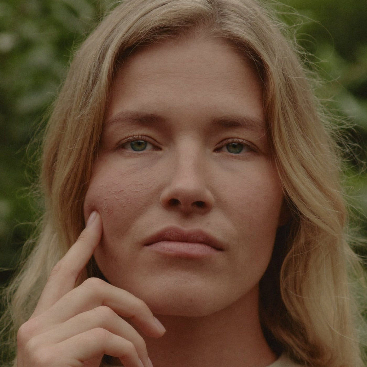 Close-up of a woman with dry skin